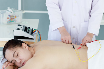 hand of doctor performing acupuncture therapy . Asian female undergoing acupuncture treatment with a line of fine needles inserted into the her body skin in clinic hospital