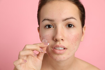 Teen girl applying acne healing patch on light pink background