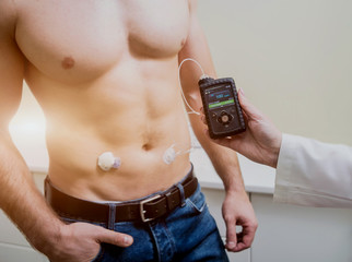 The doctor connects an insulin pump to a patient with diabetes. A concept of diabetes.