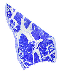 Skeletal muscle tissue longitudinal section under a microscope
