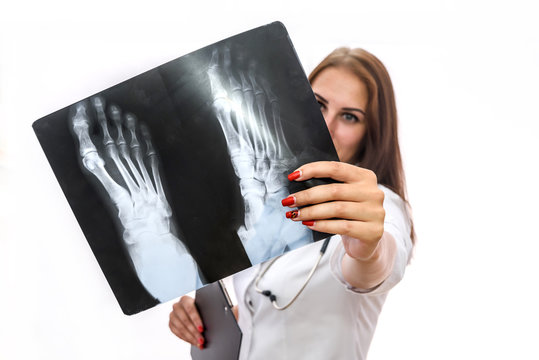 Doctor examining x-ray. Beautiful woman in medical coat with patient's x-ray isolated on white