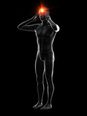 3d rendered medically accurate illustration of a man suffering from headache