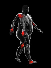 Fototapeta na wymiar 3d rendered medically accurate illustration of an obese runners painful joints