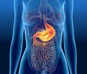 Gastritis, escherichia coli bacteria in stomach, medically concept, 3D illustration
