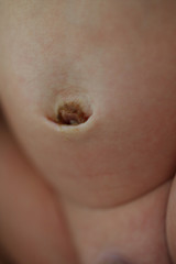 navel of newborn baby, closeup image