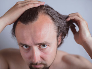 Obraz premium Portrait of a young guy with magnificent hair that falls early on his forehead. The problem of premature aging. Combing hair and indignantly looking in the mirror