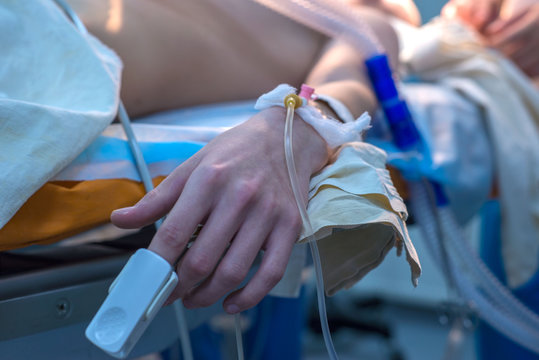 Close-up, A Catheter For A Dropper In A Child In A Vein. Little Patient Lies On An Operating Table, Sedation And Anesthesia