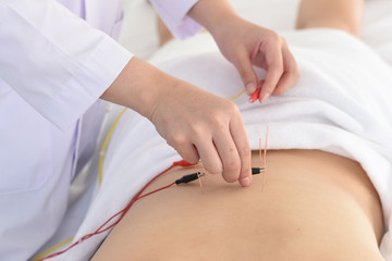 Obraz na płótnie Canvas Acupuncture treatment therapy