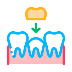 Stomatology Tooth Crown Vector Thin Line Sign Icon. Crown Dentist, Instrument Tool Equipment And Device Linear Pictogram. Medical Treatment Therapy Dentistry Contour Illustration