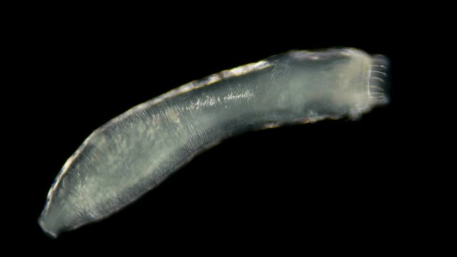 microscopic sea cucumber, class Holothuroidea, Synaptidae family, a relative of starfish and hedgehogs. They feed on plankton and organic residues extracted from silt and sand, some species filter wat