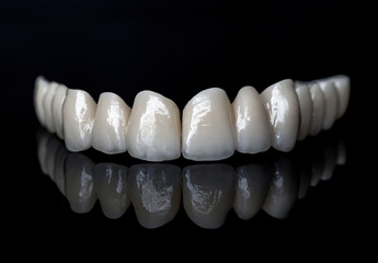 Ceramic zircon bridge - Dental technician work
