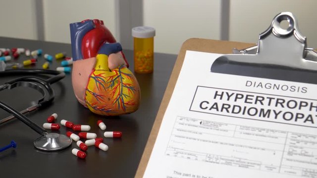 Hypertrophic Cardiomyopathy patient diagnosis on a medic office with pills, stethoscope and anatomy models. Camera panning reveling the notebook with the medical record copy.