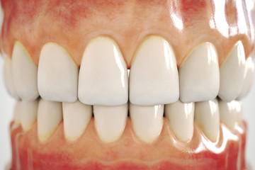 invisible dental implant on white background - 3D Rendering