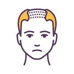 Fototapeta premium Man with a bald head color line icon. Baldness stage. Alopecia. Pictogram for web page, mobile app, promo. UI UX GUI design element. Editable stroke.