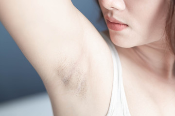 Women problem black armpit with grey background for skin care and beauty concept, selective focus