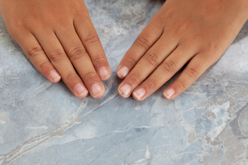 Nail clippers at your finger. Close up of fingernail cutting. Dirty nails. Long finger nails.