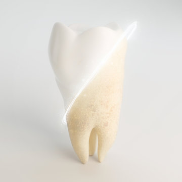 tooth before and after professional tooth cleaning - dental white concept - 3D Rendering