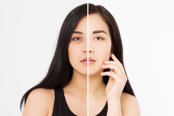 Before after asian woman face closeup isolated on white background. Before-after skin dark circles under eyes. Face care and cosmetic treatment.