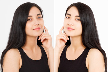 Before after close up asian woman face with dark circles under eyes and problem skin. Beauty skin care treatment. Before-after Facial problems. Dermatology cosmetology changing procedures.