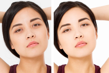 Closeup before after asian woman face. Before-after cosmetic procedures. Skin care wrinkled face,...