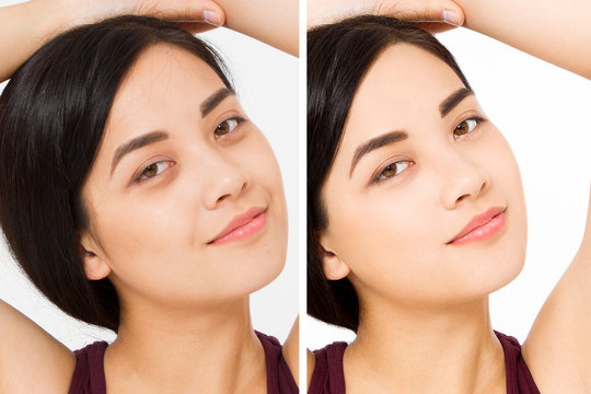Closeup before after asian woman face. Before-after cosmetic procedures. Skin care wrinkled face, dark circles under eyes. Before-after anti-aging facelift treatment. Facial skincare beauty contouring