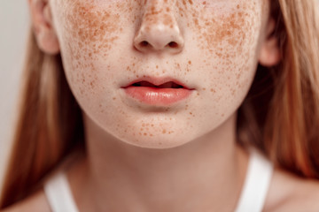 Inclusive Beauty. Girl with freckles standing isolated on grey lips close-up - obrazy, fototapety, plakaty
