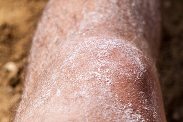 Arm covered by salt after bathing in the Dead Sea, Jordan