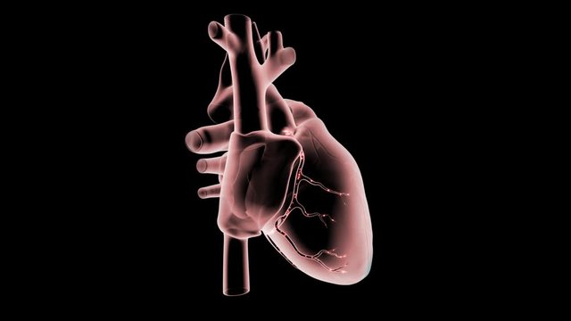 Apical Myocardial Ischemia