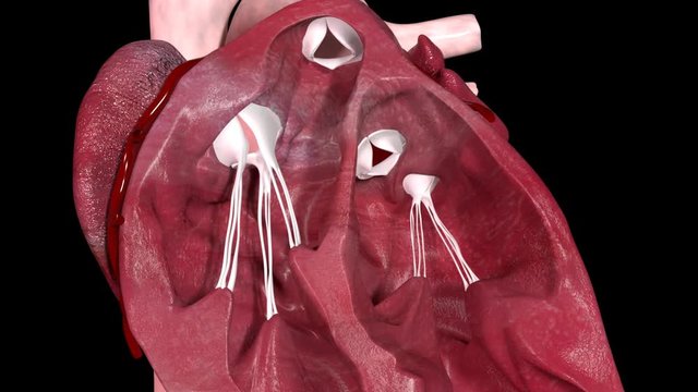 Heart Valves