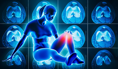 Young athletic woman laying on the ground holding her painful and injured knee with left knee CT scan in the background. Sport, medical and healthcare, injury conceptual 3d rendering illustration.
