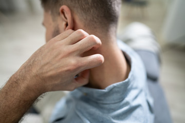 Man Scratching Itch On His Neck