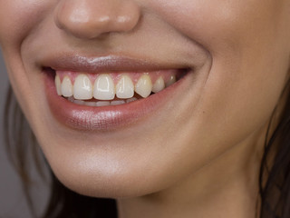 close-up portrait of a snow-white woman's smile for dentistry. Beautiful sexy full lips with natural lip gloss. smooth teeth and clean dark skin