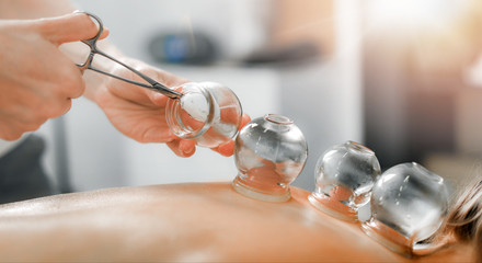 Detail of a woman therapist hands giving cupping treatment on back.