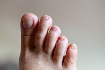 young girl's toes are healthy and beautiful. Well-groomed Concept for medical articles and...