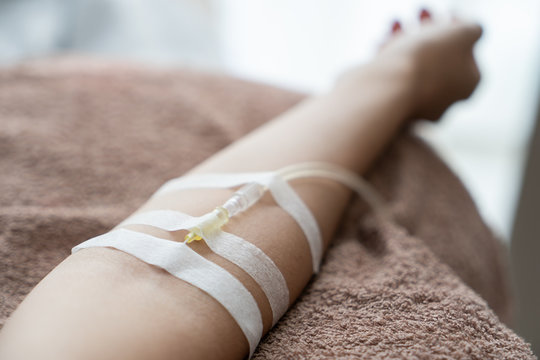 Patient with intravenous drip .receiving saline solution. Injecting needle in to the arm.