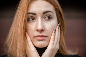 Acne and scars, simple woman close up natural portrait, No makeup and retouch. Problem skin