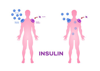 Insulin unlocks the cell's glucose channel vector / pancreas and blood vessel