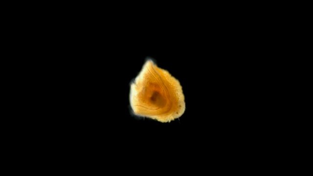 Entoprocta larva under a microscope, a type of Protostomia animals, used to be considered as members of Trochozoa, are actually closely related to bryozoans, perhaps this is a new species, there is ve