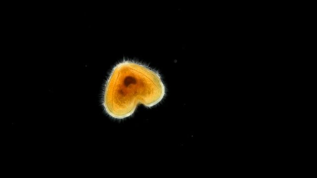 Entoprocta larva under a microscope, a type of Protostomia animals, used to be considered as members of Trochozoa, are actually closely related to bryozoans, perhaps this is a new species, there is ve