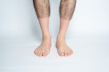 Obraz na płótnie Canvas Legs hair removal for men, before & after. Applies only to visible space when wearing pants.