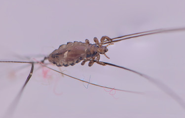 Macro Close Up  Pediculus humanus capitis head louse