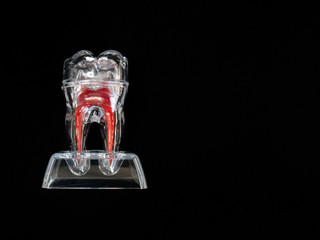 Crystal clear and transparent implant of dental tooth figure with red root object for dentist...