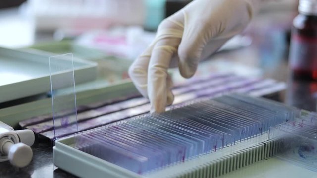 Close up of Laboratory Assistant or scientist hands checking blood sample glass slides from the archive or old records at hospital laboratory.