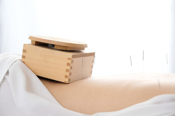 明るい鍼灸院で女性の腰に乗せられた箱灸