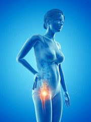 3d rendered medically accurate illustration of a woman having a painful hip