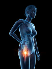 3d rendered medically accurate illustration of a woman having a painful hip