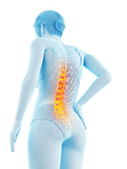3d rendered medically accurate illustration of a woman having backache