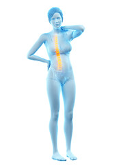 3d rendered medically accurate illustration of a woman having a backache