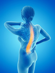 3d rendered medically accurate illustration of a woman having a backache