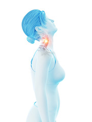 3d rendered medically accurate illustration of a woman having a painful neck